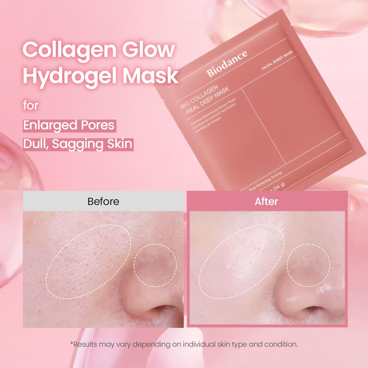 Glow & Renew Skin Mask Set